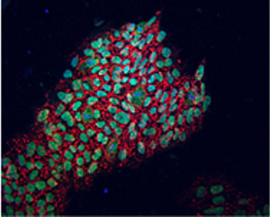 Впервые лаборатория  Исписуа Бельмонте заменила ген Oct4, ранее считавшийся совершенно необходимым для получения человеческих индуцированных плюрипотентных стволовых клеток. На снимке перепрограммированные новым методом клетки, экспрессирующие маркеры плюрипотентности, идентифицированные с помощью иммунофлуоресцентного анализа. (NANOG зеленый, TRA-1-81 красный).